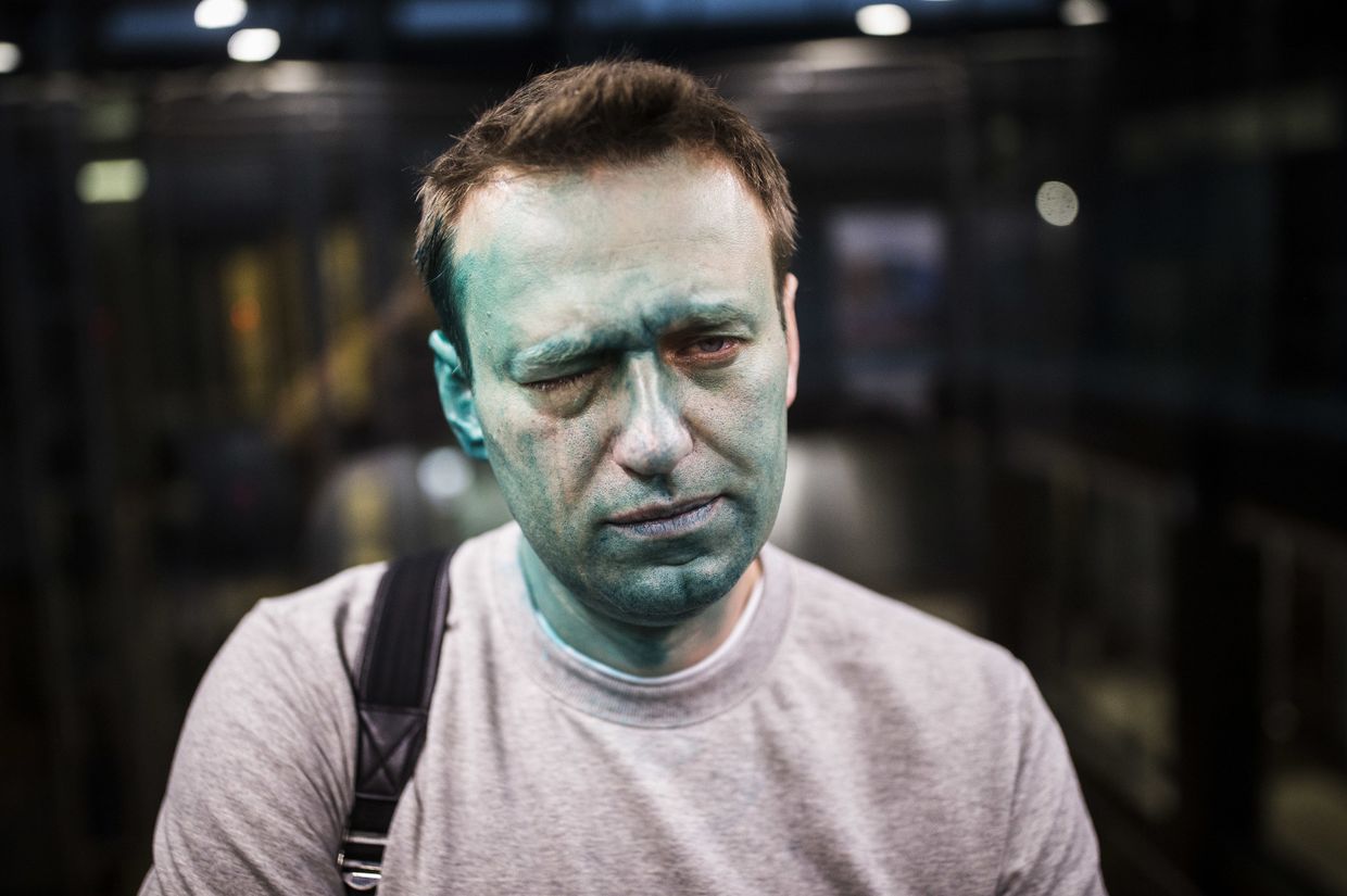 Российский оппозиционер Алексей Навальный после нападения на него неизвестных злоумышленников Российский оппозиционер Алексей Навальный после нападения на него неизвестных злоумышленников