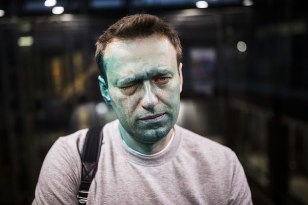 Российский оппозиционер Алексей Навальный после нападения на него неизвестных злоумышленников