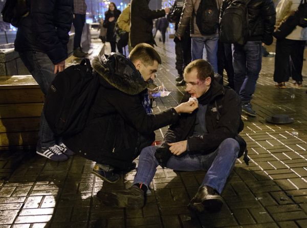 Французский болельщик, пострадавший во время драки в Киеве после матча клуба Сент-Этьен с ФК Днепр
