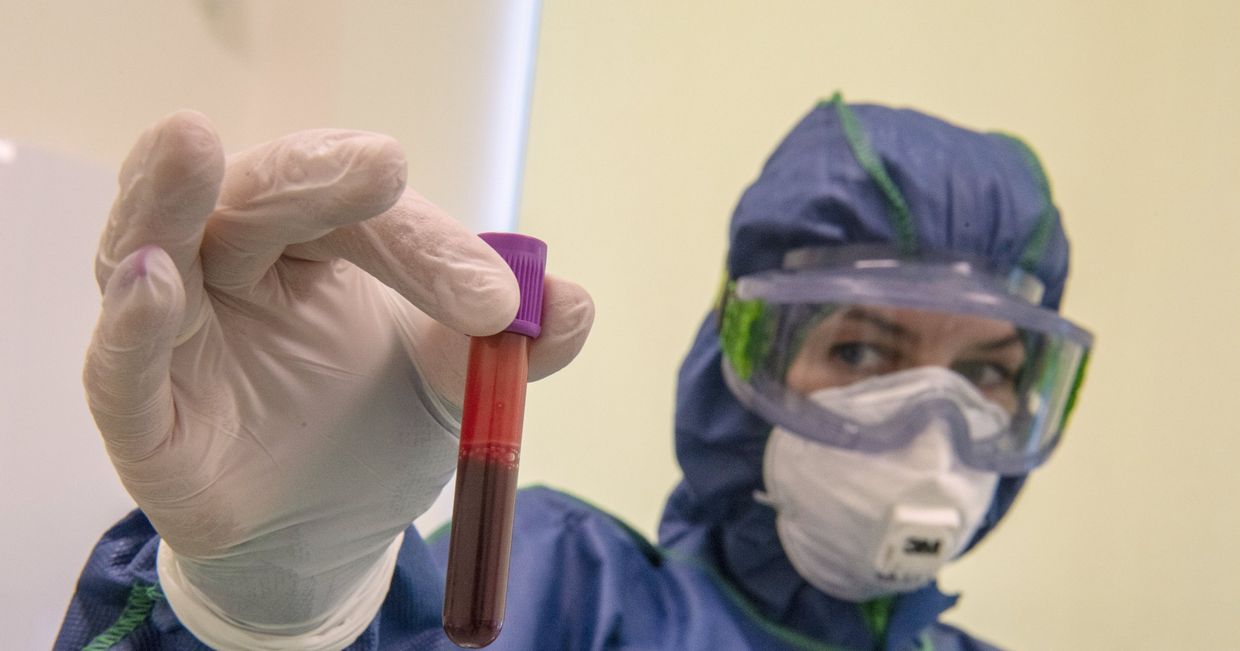 Экспресс-диагностика на антитела к коронавирусу в клинике Hadassah Medical Moscow в Сколково